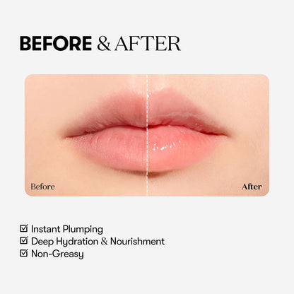 Reedle Shot Lip Plumper Beginner