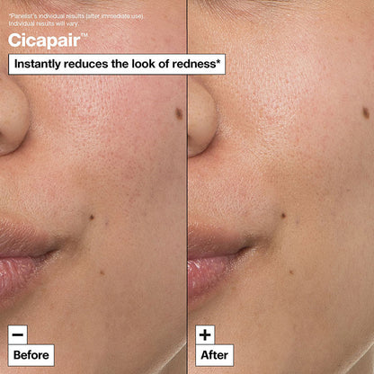 Cicapair™ Intensive Soothing Repair Cream